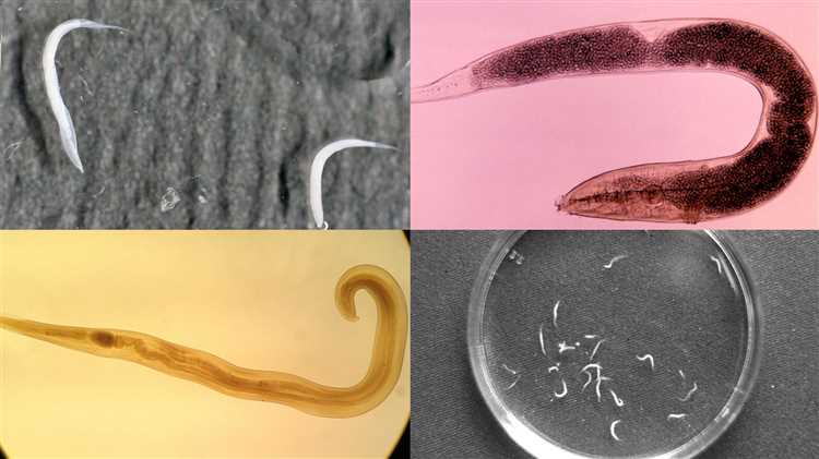 Как избавиться от паразитов в организме?