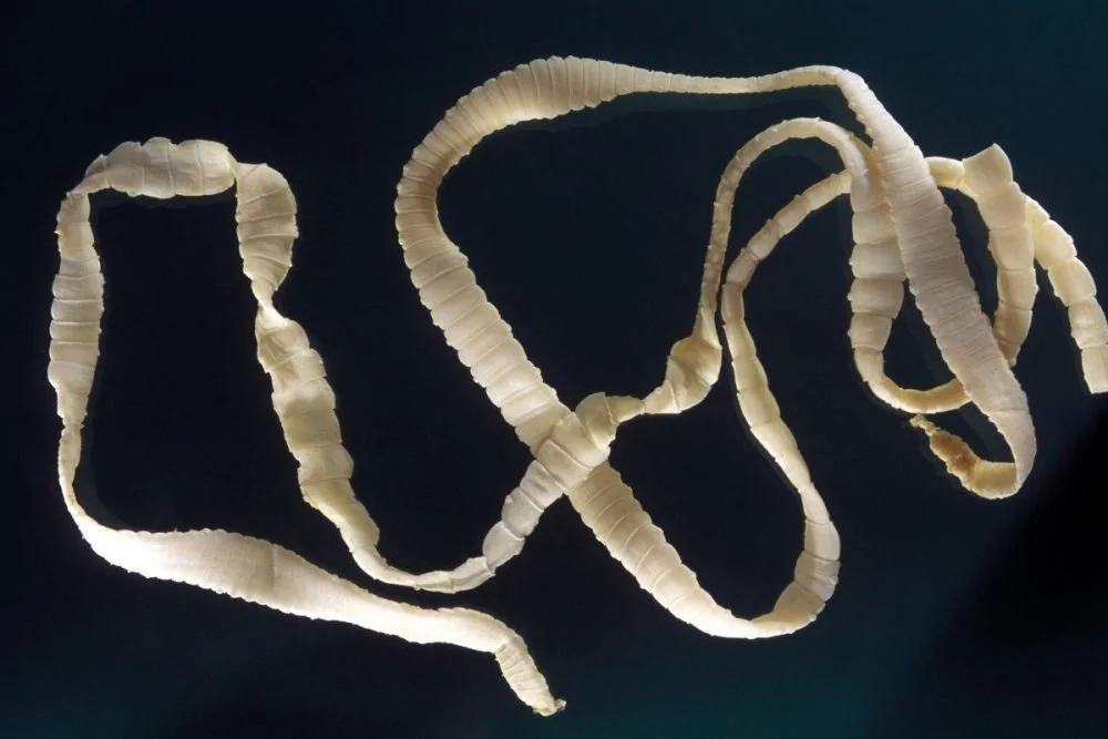 Какие черви вызывают гельминтоз у человека?