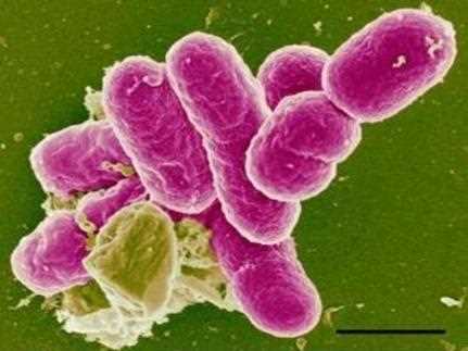 Микроорганизм, вызывающий дизентерию