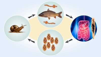 1. Потребление сырых или недостаточно термически обработанных рыб и морепродуктов