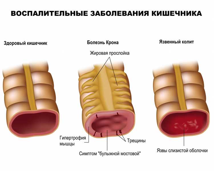 б) Другие симптомы глистовых инфекций