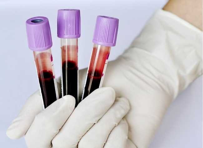 При каком анализе крови можно выявить описторхоз?