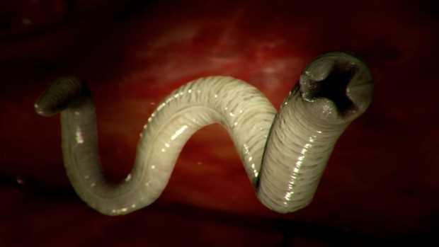 Сколько живет ленточный червь в человеке?
