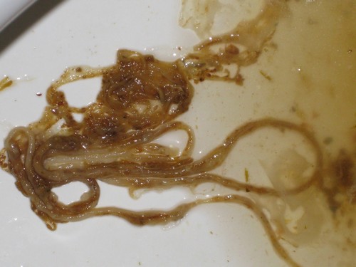 черви вышли из организма человека 