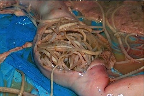 паразиты в кишечники фото