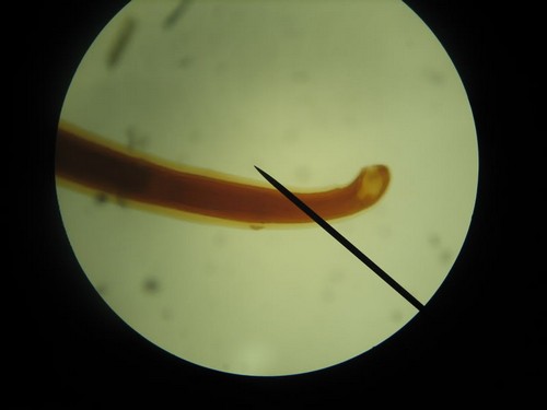 Внешний вид червя ankylostoma